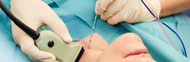 Localisation du lieu de travail. Thyroide Chl