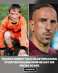 🗣️ 'When you are a child and you have a scar like this, it's not easy. The  way people see you, the comments