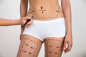 Tummy Tuck With Thigh Lift Kronowitz Plastic Surgery In Houston Tx