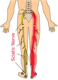 Your doctor may diagnose your pain as a bulging disc, herniated disc, ruptured disc, or even slipped disc. Slipped Disc In New Delhi Neb Sarai By Accupressure Heals Id 7123994455