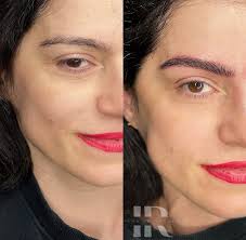 Micropigmentación3D