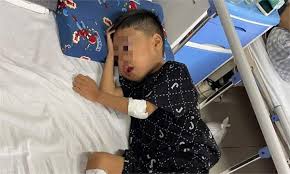 Chất gây UT cấp độ 1 này được 'giấu' trong phòng ngủ của trẻ em. Thời gian tiếp xúc càng lâu thì nguy cơ càng lớn