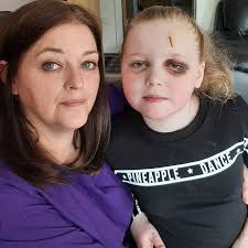 Mum of girl, 8, who suffers 300 seizures a day says daughter 'robbed of her  childhood'