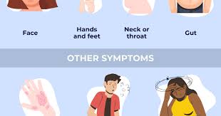 Image result for Angioedema