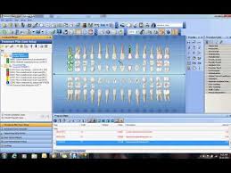 Dental Charting Symbols Uk Related Keywords
