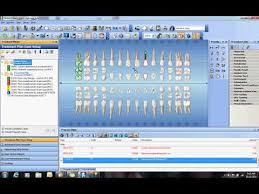 Dental Charting Symbols Uk Related Keywords