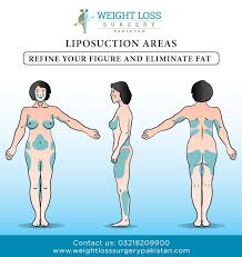 Pin Op Liposuction