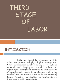 Image result for Active Management of Labor