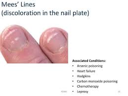 Image result for Mees Line