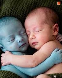 Please, My Mom's Been Asleep for Three Days. I Need Someone to Help.” — The  7-Year-Old Who Pushed a Wheelbarrow Carrying Her Infant Siblings for Miles  to the Hospital That morning, the