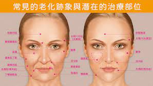 Atnextsub@nextdigital.com.hk 熱線：2623 9985 《蘋果》調查組 whatsapp/telegram: è˜‹æžœè‚Œæ˜¯ä»€éº¼ ä¸‹åž‚æ€Žéº¼è¾¦ 3å¤§åŽŸå› èªªæ˜Ž å†ä¹Ÿä¸æ€•é¬†åž®ç„¡å½ˆæ€§ å½¥éšè¨ºæ‰€ é†«ç¾Ž æ¸›é‡