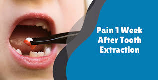 Image result for Tooth Extraction