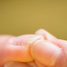 Check spelling or type a new query. 10 Reasons For Brittle Nails Causes And Treatments For Weak Nails