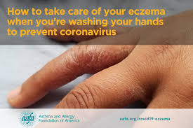 You can really see the spot good with the screen on a. Eczema Handwashing And The New Coronavirus Covid 19 Protecting Yourself And Your Skin Asthma And Allergy Foundation Of America
