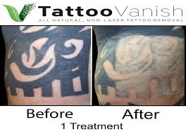 Prior to the $50 million commitment by elliott, the privately held business was funded by australian investors. Tattoo Vanish The Best All Natural Non Laser Tattoo Removal Fast Eyebrow Tattoo Removal Near Me Tattoo Removal Cream