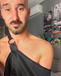 🦴 Fractura 😔🦴 El resultado a una buena rodada por las escaleras 🥲 🧑‍⚕️  Diagnóstico: fractura subcapital + troquiter izquierdo = 6 meses aprox. de  recuperación ❤️‍🩹 Sé que podría ser mucho