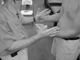 Image result for Rotator Cuff Triad Test