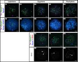 11.4 meiosis lesson objectives contrast the number of chromosomes in body cells and in gametes. The Telomere Bouquet Is A Hub Where Meiotic Double Strand Breaks Synapsis And Stable Homolog Juxtaposition Are Coordinated In The Zebrafish Danio Rerio