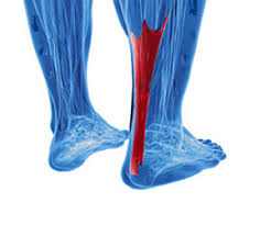 Biceps tendon tears can be either partial or complete. What Is An Achilles Tendon Rupture