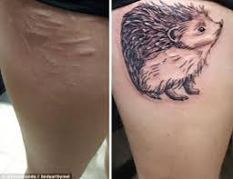 A scar which protrudes from the skin to form a fleshy growth is much more challenging to tattoo over, and may be met with resistance from tattoo artists. Tattooing Scars And Stretchmarks Timeless Tattoo 2021