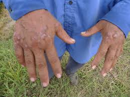 Maybe you would like to learn more about one of these? Padi Sri Akibat Menggunakan Racun Berlebihan Weblog Padi Selangor Pertanian Selangor