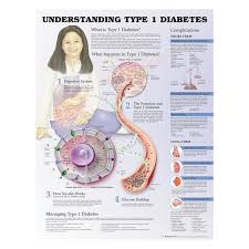 09 31 9755 Understanding Type 1 Diabetes Chart