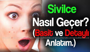 Sivilceye Dogal Tedavi Yontemleri Sivilce Tedavisi Bitkisel Sivilce Tedavisi Bitkilerle Sivilce Tedavisi Sivilce Neden Olur Si Dogal Tedaviler Dogal Bitki