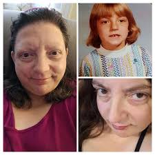 Interrupting my ⚾️⚾️⚾️ posts to show this... I *think* I still look like me  but cancer aged me...