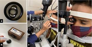 Image result for Gonioscopy