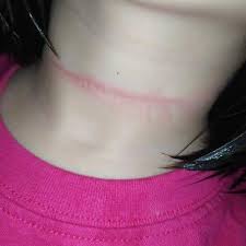 Mental disorders (including depression, bipolar disorder, autism spectrum disorders, schizophrenia, personality disorders, anxiety disorders), physical disorders (such as chronic fatigue. Mum Finds 4 Year Old Hanging Herself In Attempt To Copy Tiktok Video