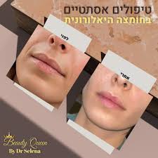 Beauty Queen by Dr Selena