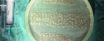 Il trapianto di capelli dopo 2 mesi · praticare sport come body building, mare e piscina · avrà vissuto il fenomeno dello shock loss · potrà . Vademecum Post Trapianto Di Capelli Fue Firstduty E Mayhemag