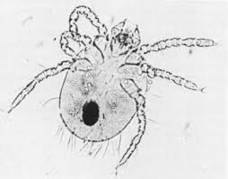 Image result for Trombicula autumnalis