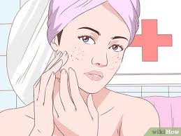 To get rid of your liv. 6 Ways To Get Rid Of Acne Without Using Medication Wikihow