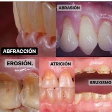 Pin By Dentistry Buzz On Dental Students Dental Life Dental Dental Health
