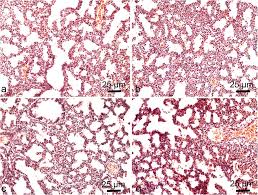Parenchyma (/pəˈrɛŋkɪmə/) is the bulk of functional substance in an animal organ or structure such as a tumour. Histology Of Lung Tissue Lung Parenchyma Of Hematopoietic Stem Cell Download Scientific Diagram