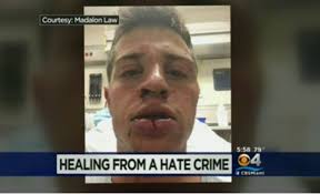 Gay Man Attacked In Burger King For Kissing His Boyfriend
