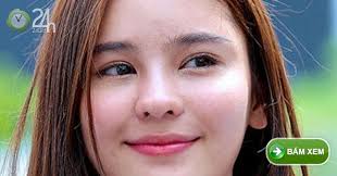 Giới trẻ châu Âu thường ít mụn: Chả phải do môi trường hay khí hậu mà vì...