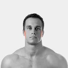 The female sideburns laser hair removal package includes 6 treatments of both sideburns, covering the area extending from the hairline to the jawline or just below the ears. Sideburns Laser Hair Removal For Men Best Laser Room London