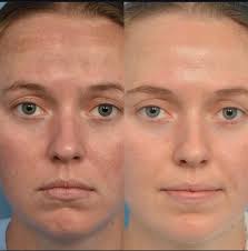 Destin Bell (@skinandbrows904) • Instagram photos and videos