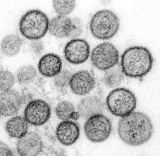 The disease can be transmitted to people that are in close contact with. High Cholesterol Good For Hantavirus