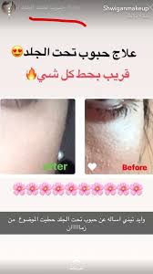 Pin By وهم On منتجات العنايه بالبشره والشعر Healthy Recipes Care Self Care