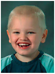 Facial features of case 16.