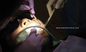 Check spelling or type a new query. Pengalaman Scaling Dan Polishing Gigi Di Klinik Pergigian Dentessence Mawardi Yunus