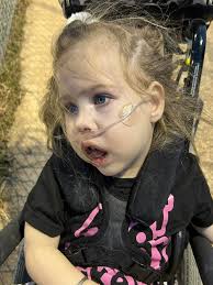 She still needs oxygen at home.