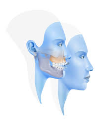 We did not find results for: Mordida Abierta Cirugia Ortognatica Instituto Maxilofacial