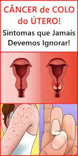 El cáncer puede causar muchos síntomas. Cancer De Colo Do Utero Sintomas Que Jamais Devemos Ignorar Cancer De Colo Do Utero Colo Do Utero Remedios Para Dor De Garganta