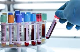 Sesso e AIDS: l'HIV si trasmette anche tramite il rapporto orale | MEDICINA  ONLINE