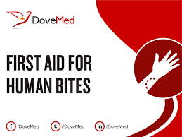 How much force does a human bite generate? First Aid For Human Bites