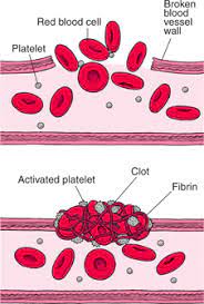 When you get a cut or wound, your body forms blood clots, a thickened mass of blood tissue, to help stop the bleeding. Quick Facts How Blood Clots Msd Manual Consumer Version